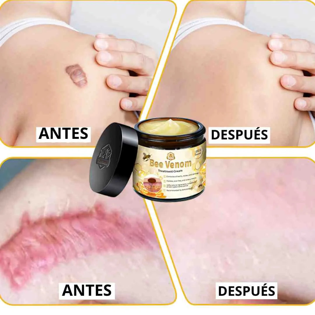 CREMA VENENO DE ABEJAS