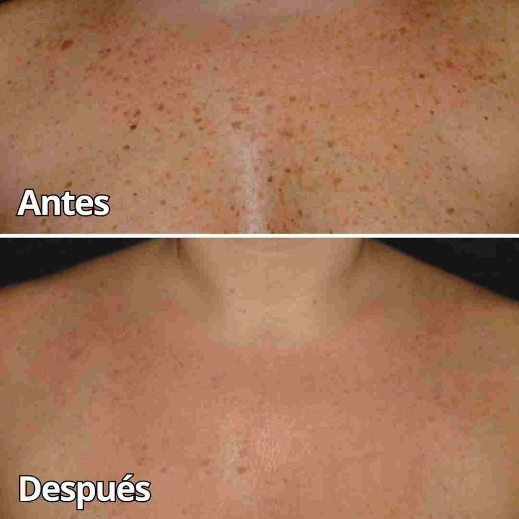 CREMA VENENO DE ABEJAS