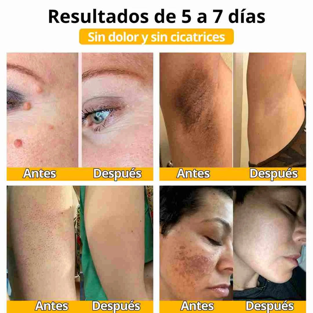 CREMA VENENO DE ABEJAS